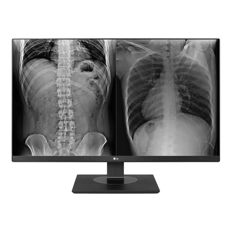 LG Clinical Review Monitor - Écran LED - 8MP - couleur - 27" - 3840 x 2160 4K - IPS - 350 cd - m² - 1000... (27HJ713C-B)_1