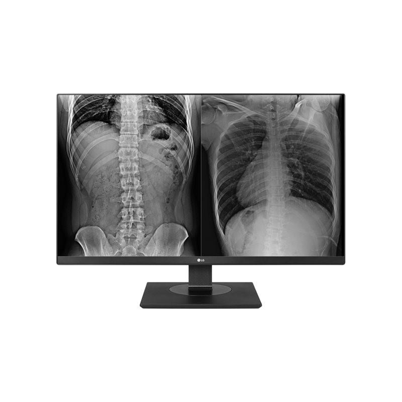 Écran LED - 8MP - couleur - 27" - 3840 x 2160 4K - IPS - 350 cd - m² - 1000:1 - 14 ms - 2xHDMI, Dis... (27HJ713C-B)_1
